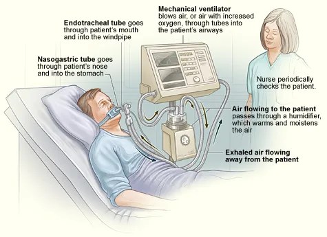 Ventilator diagram